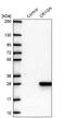 Crystallin Gamma N antibody, NBP2-14708, Novus Biologicals, Western Blot image 