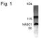 Breast Carcinoma Amplified Sequence 1 antibody, PA1-4398, Invitrogen Antibodies, Western Blot image 