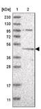 DEP Domain Containing MTOR Interacting Protein antibody, NBP1-85255, Novus Biologicals, Western Blot image 