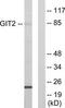 ARF GTPase-activating protein GIT2 antibody, TA314970, Origene, Western Blot image 