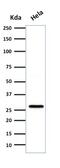 Heat Shock Protein Family B (Small) Member 1 antibody, GTX34782, GeneTex, Western Blot image 