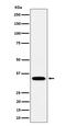 Phosphopantothenoylcysteine Synthetase antibody, M05567-1, Boster Biological Technology, Western Blot image 