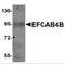 EF-hand calcium-binding domain-containing protein 4B antibody, MBS150468, MyBioSource, Western Blot image 
