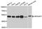 Rho GTPase Activating Protein 1 antibody, A3739, ABclonal Technology, Western Blot image 