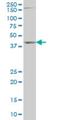 Distal-Less Homeobox 2 antibody, H00001746-M01, Novus Biologicals, Western Blot image 