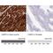 Cysteine And Glycine Rich Protein 3 antibody, NBP2-13880, Novus Biologicals, Immunohistochemistry paraffin image 