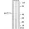 Acyl-CoA Thioesterase 2 antibody, A10261, Boster Biological Technology, Western Blot image 