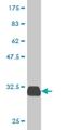 Pancreatic secretory trypsin inhibitor antibody, H00006690-M01, Novus Biologicals, Western Blot image 