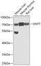 DNA Nucleotidylexotransferase antibody, GTX33539, GeneTex, Western Blot image 