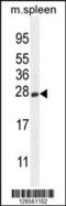 Crystallin Gamma S antibody, 55-379, ProSci, Western Blot image 
