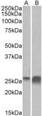 Apolipoprotein D antibody, PA5-37838, Invitrogen Antibodies, Western Blot image 