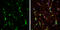 Calcium/Calmodulin Dependent Protein Kinase II Beta antibody, GTX133072, GeneTex, Immunofluorescence image 