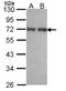 Papillary thyroid carcinoma-encoded protein antibody, NBP1-31882, Novus Biologicals, Western Blot image 