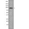 Ataxin 7 Like 1 antibody, PA5-68101, Invitrogen Antibodies, Western Blot image 