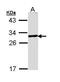 Glutamate-Cysteine Ligase Modifier Subunit antibody, GTX111858, GeneTex, Western Blot image 