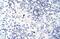 Zinc Finger And BTB Domain Containing 38 antibody, PA5-69063, Invitrogen Antibodies, Immunohistochemistry frozen image 