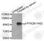 Protein Tyrosine Kinase 2 Beta antibody, AP0214, ABclonal Technology, Western Blot image 