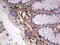 Protein C Receptor antibody, LS-C339647, Lifespan Biosciences, Immunohistochemistry paraffin image 