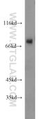 T-Box, Brain 1 antibody, 20932-1-AP, Proteintech Group, Western Blot image 