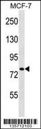 Solute Carrier Family 24 Member 3 antibody, 58-449, ProSci, Western Blot image 