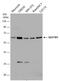 Sequestosome 1 antibody, GTX128173, GeneTex, Western Blot image 