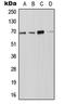 NADPH Oxidase 4 antibody, LS-C353434, Lifespan Biosciences, Western Blot image 