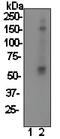 LYN Proto-Oncogene, Src Family Tyrosine Kinase antibody, ab40660, Abcam, Western Blot image 