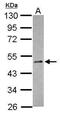RNA Binding Motif Protein 41 antibody, PA5-31243, Invitrogen Antibodies, Western Blot image 