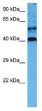 SRY-Box 18 antibody, GTX57216, GeneTex, Western Blot image 