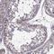 CDC42 Binding Protein Kinase Alpha antibody, HPA071252, Atlas Antibodies, Immunohistochemistry frozen image 