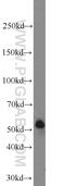 Transmembrane Serine Protease 2 antibody, 14437-1-AP, Proteintech Group, Western Blot image 