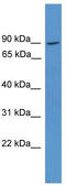 NCK Interacting Protein With SH3 Domain antibody, TA342636, Origene, Western Blot image 