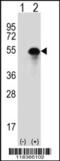 Carbonic anhydrase 14 antibody, 62-807, ProSci, Western Blot image 