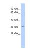 Shisa Family Member 5 antibody, NBP1-59053, Novus Biologicals, Western Blot image 