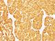 Melan-A antibody, NBP2-44393, Novus Biologicals, Immunohistochemistry frozen image 