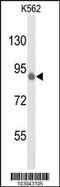 Tousled Like Kinase 1 antibody, 63-397, ProSci, Western Blot image 