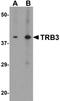 Tribbles Pseudokinase 3 antibody, NBP2-82067, Novus Biologicals, Western Blot image 
