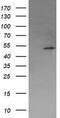 Protein Phosphatase, Mg2+/Mn2+ Dependent 1B antibody, M05731-1, Boster Biological Technology, Western Blot image 
