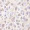 Ubiquitin-conjugating enzyme E2 A antibody, IHC-00078, Bethyl Labs, Immunohistochemistry paraffin image 