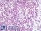 Transportin 1 antibody, LS-B10559, Lifespan Biosciences, Immunohistochemistry paraffin image 