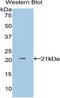 NME/NM23 Nucleoside Diphosphate Kinase 1 antibody, LS-C295664, Lifespan Biosciences, Western Blot image 