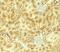 Vezatin, Adherens Junctions Transmembrane Protein antibody, PA5-72819, Invitrogen Antibodies, Immunohistochemistry frozen image 