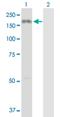 Collagen Type III Alpha 1 Chain antibody, H00001281-D01P, Novus Biologicals, Western Blot image 