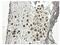 Platelet Derived Growth Factor Receptor Alpha antibody, GTX52457, GeneTex, Immunohistochemistry paraffin image 