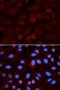 Aldehyde Dehydrogenase 3 Family Member A1 antibody, LS-C334098, Lifespan Biosciences, Immunofluorescence image 