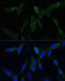 ZW10 Interacting Kinetochore Protein antibody, 22-131, ProSci, Immunofluorescence image 