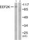 Eukaryotic Elongation Factor 2 Kinase antibody, PA5-38086, Invitrogen Antibodies, Western Blot image 