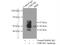 Cholinergic Receptor Nicotinic Beta 1 Subunit antibody, 11553-1-AP, Proteintech Group, Immunoprecipitation image 