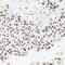 Ribonuclease P/MRP Subunit P30 antibody, 23-613, ProSci, Immunohistochemistry frozen image 