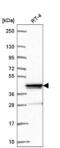 Zinc Finger Protein 618 antibody, NBP2-57450, Novus Biologicals, Western Blot image 